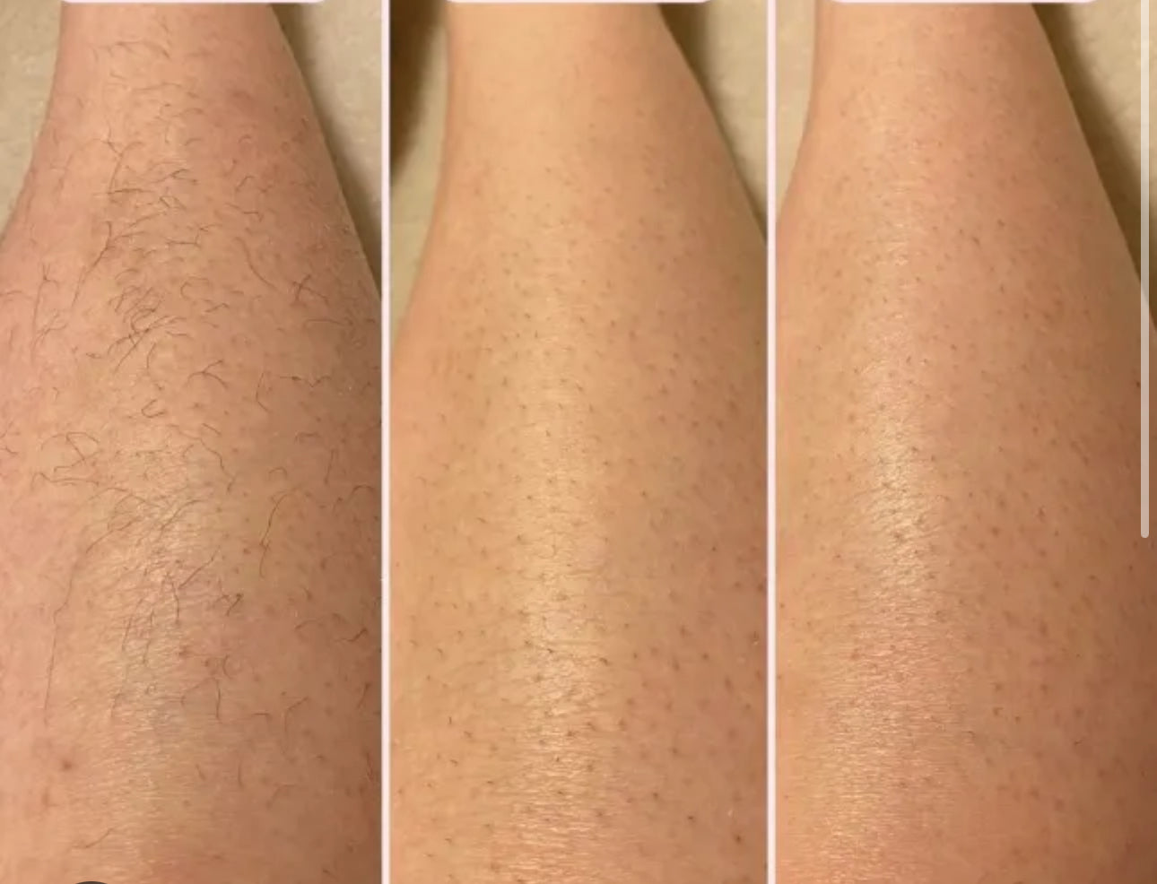 2-1 Rechargeable Hair Trimmer